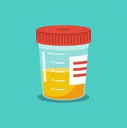 Random Drug Testing